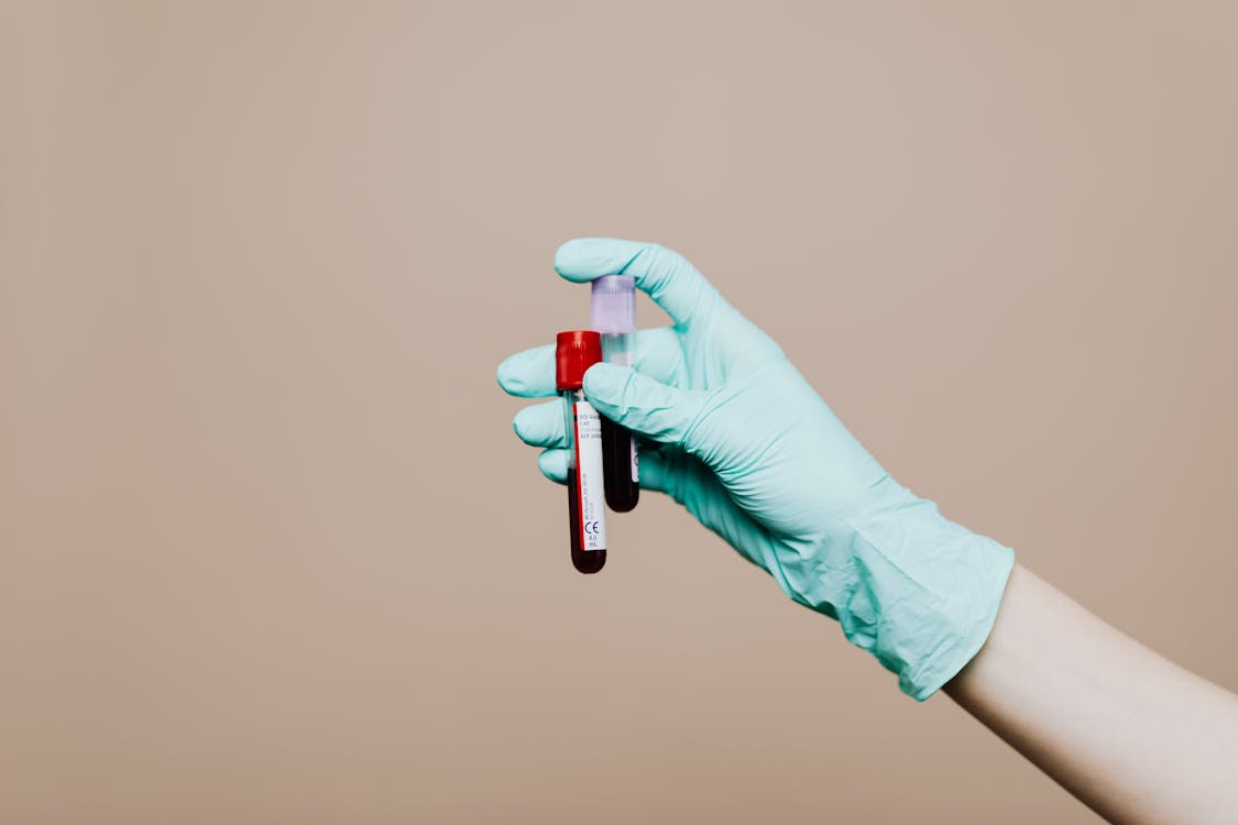 Photo by Photo By: Kaboompics.com from Pexels: Blood sample